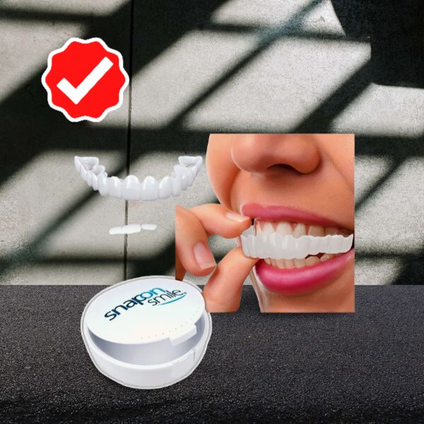 Snap on Smile